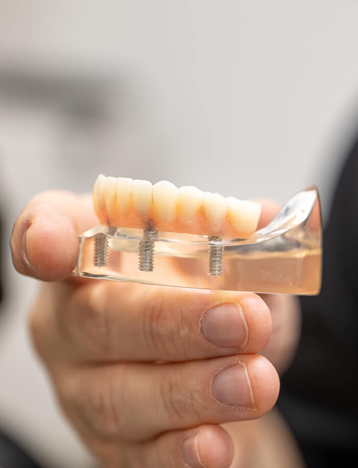 Implant Dentistry
