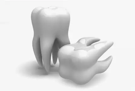 Root Canal Therapy