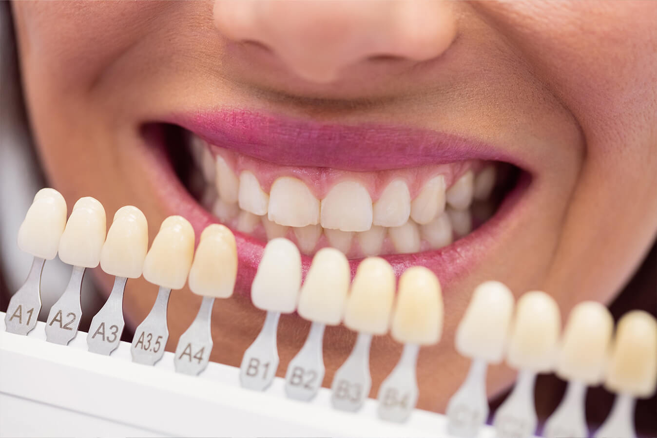Cosmetic Dentistry in Southern Westchester
